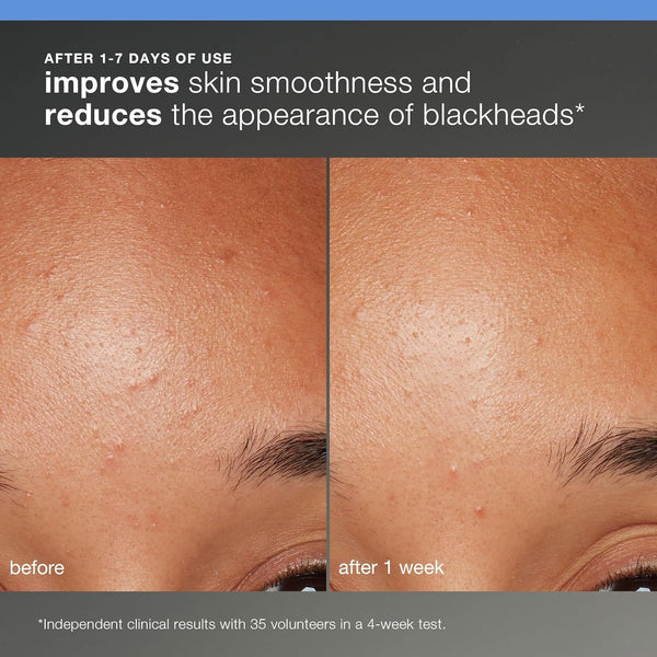 Dermalogica Skincare Discovery Kit