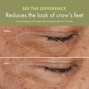 Origins Plantscription Crema para ojos con retinol y corrección de arrugas